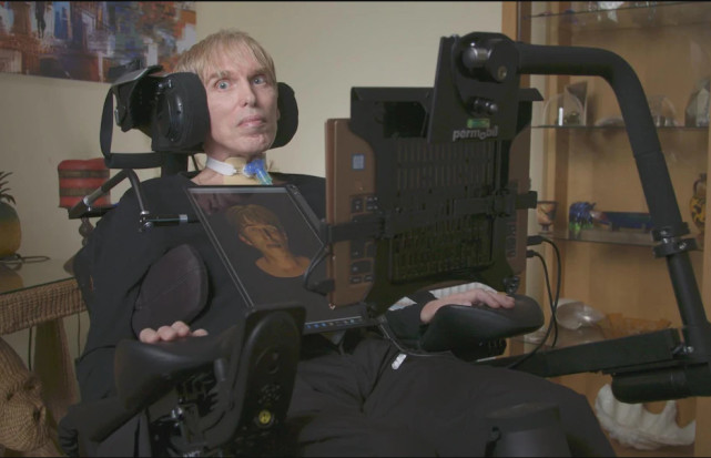 揭秘世界首位半机械人 要做人类小白鼠对抗运动神经元疾病