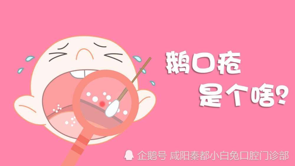 鹅口疮宝爸宝妈看到马牙时,切忌用力擦拭或用针挑破,这样既会擦伤宝宝