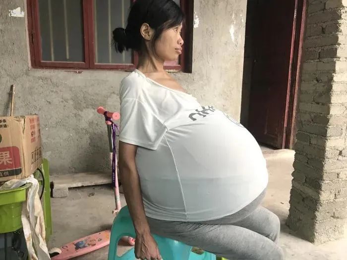"她怀孕了,孩子40斤":贵州"巨肚"妈妈确诊,最可怕的真相曝光了