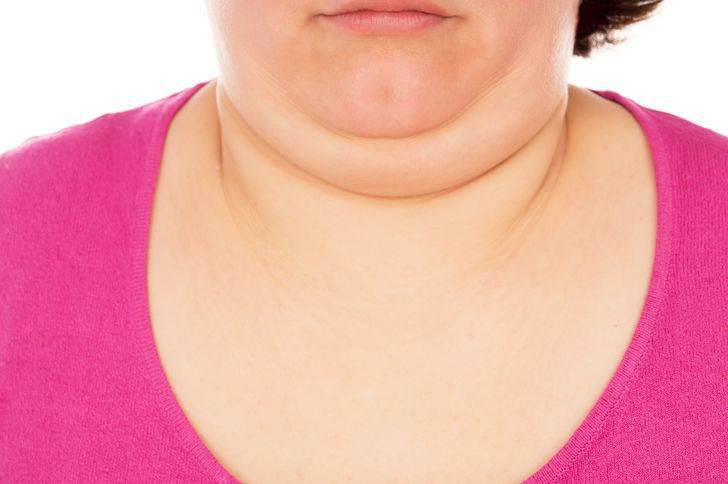 甲状腺激素分泌过多和分泌不足都会导致甲状腺肿大,导致颈部肿胀. 10.
