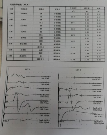 心脏超声 腹部超声 未见异常 肌电图 05 临床诊断 2型糖尿病 糖尿