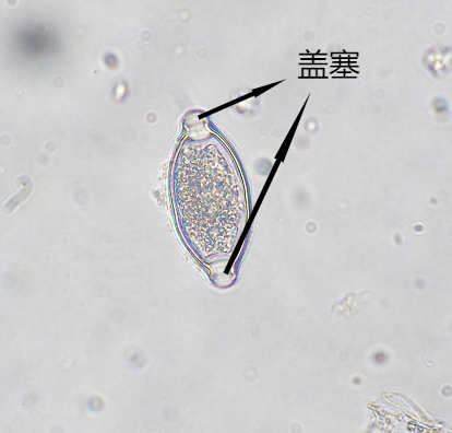 各类寄生虫卵高清图集