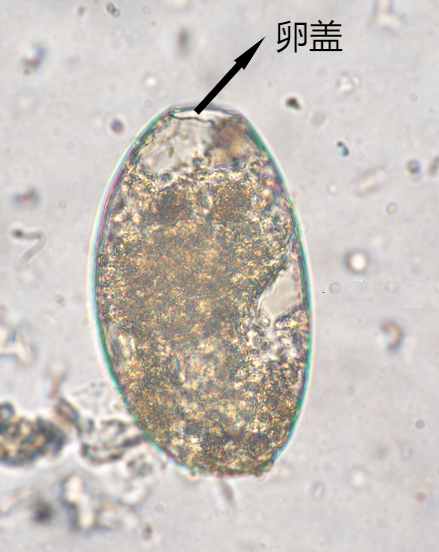 室间质评中常见寄生虫卵及鉴别要点