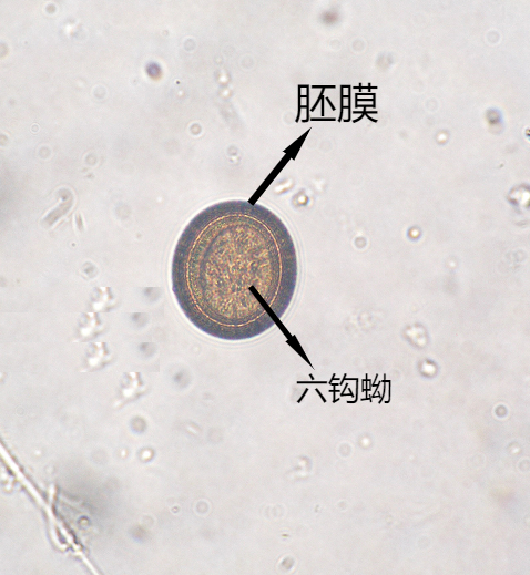 带绦虫卵4呈椭圆形,淡黄色,大小约130um×80um,虫卵一端有一透明卵盖