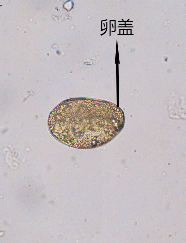 肺吸虫卵