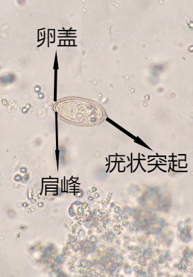 06 肝吸虫卵