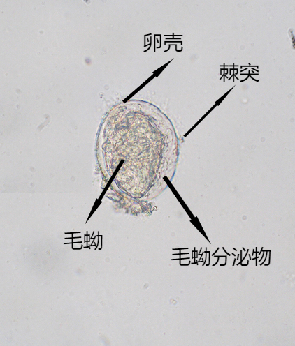 室间质评中常见寄生虫卵及鉴别要点