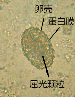 09 未受精蛔虫卵