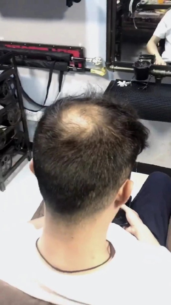 能掩盖秃头的发型