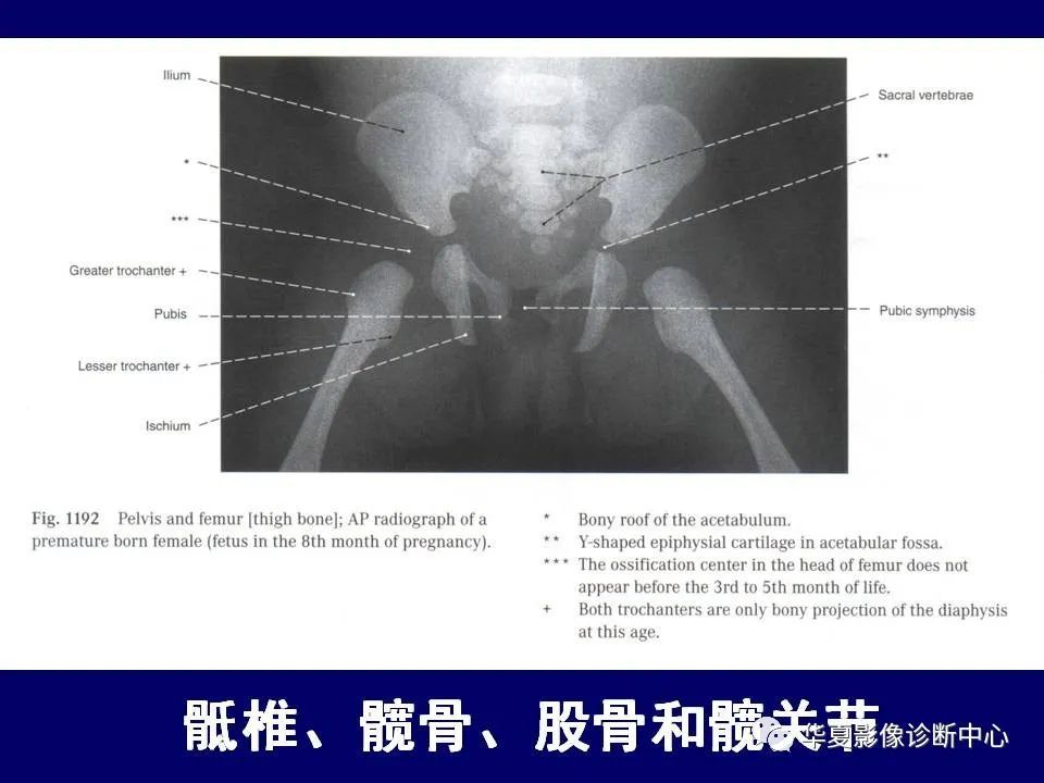 最全的下肢mrict断层解剖大体对照值得收藏