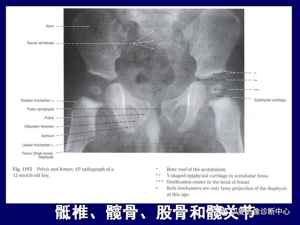 最全的下肢mrict断层解剖大体对照值得收藏