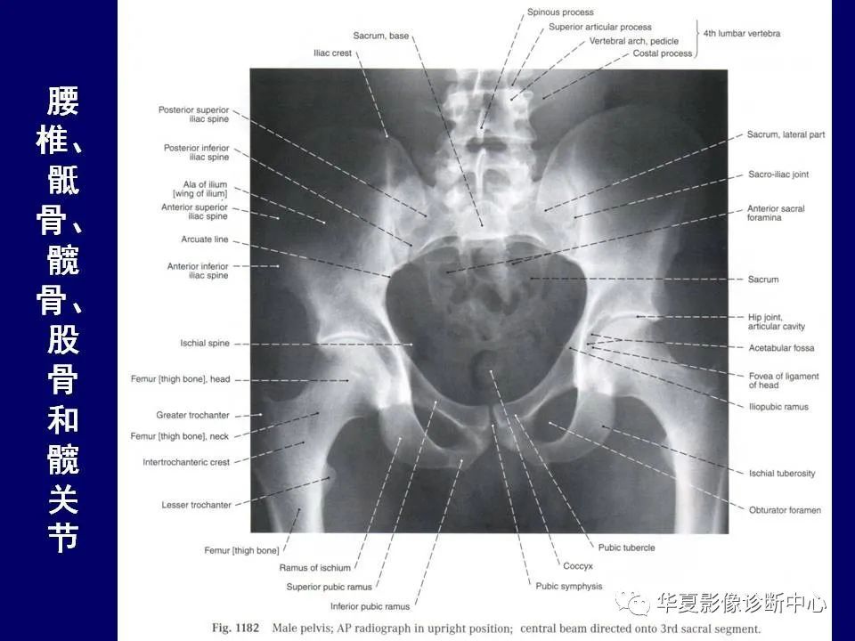 最全的下肢mrict断层解剖大体对照值得收藏