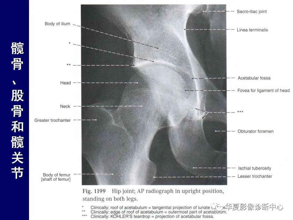 最全的下肢mri 解剖