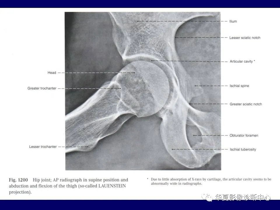 最全的下肢mri 解剖