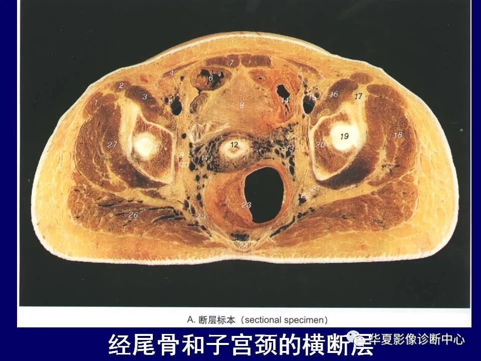 最全的下肢mri 解剖