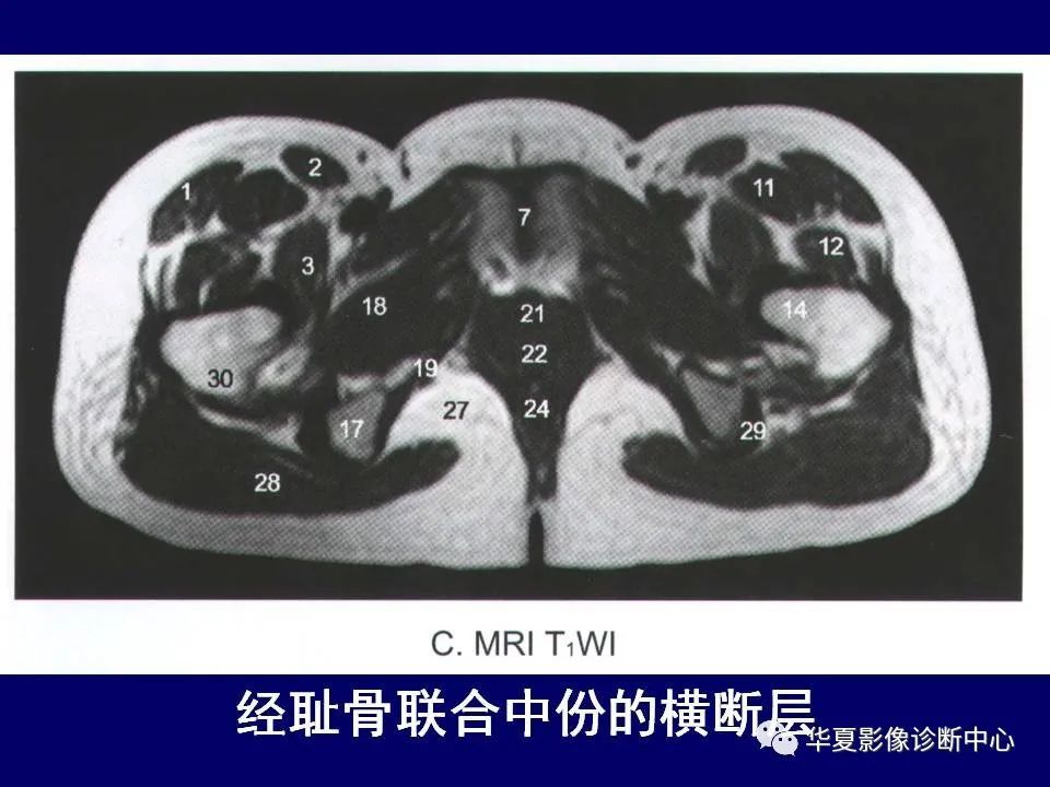 最全的下肢mri 解剖