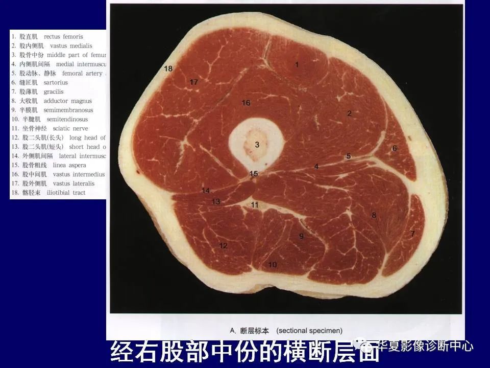 最全的下肢mri 解剖