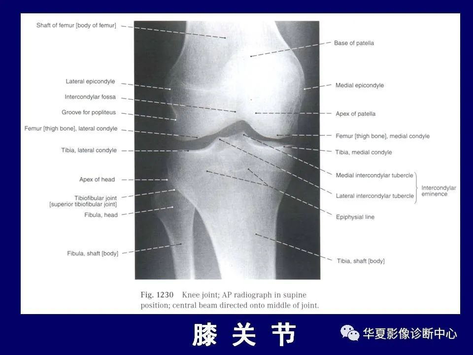 最全的下肢mri 解剖