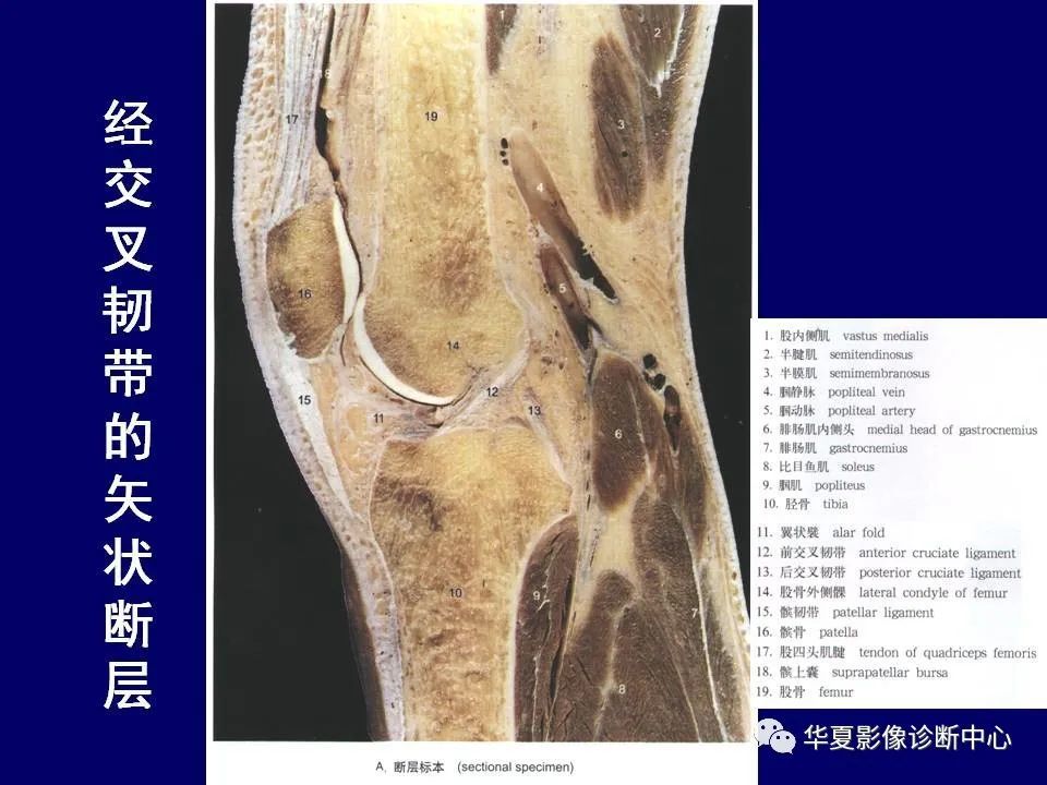 最全的下肢mri 解剖