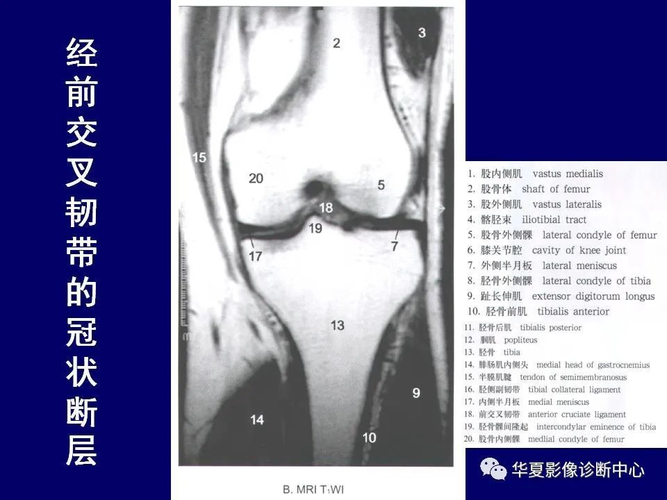 最全的下肢mrict断层解剖大体对照值得收藏