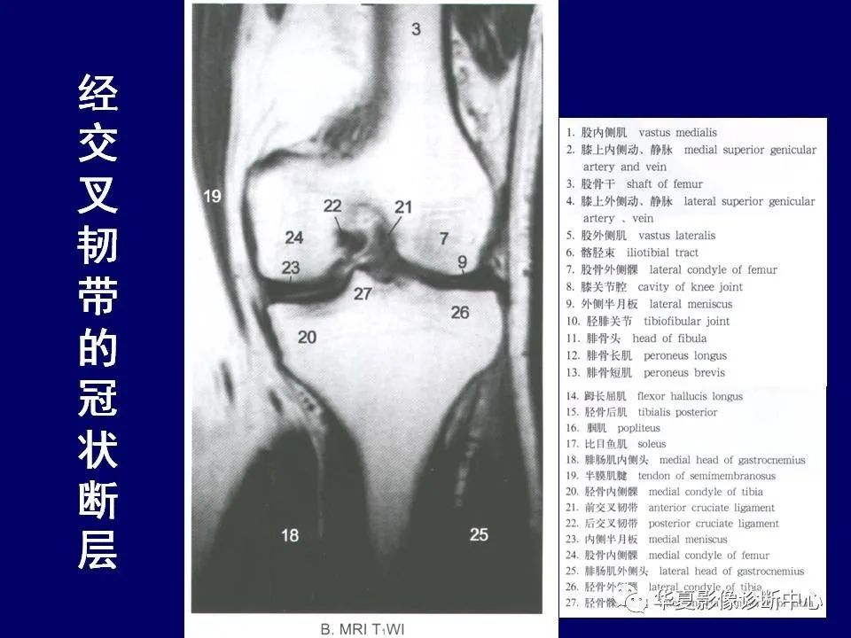 最全的下肢mrict断层解剖大体对照值得收藏