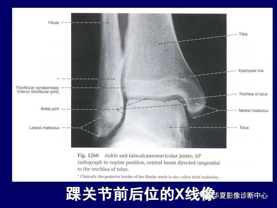 最全的下肢mrict断层解剖大体对照值得收藏