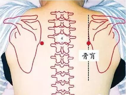 膏肓灸法:患者平坐床上,屈膝抵胸.