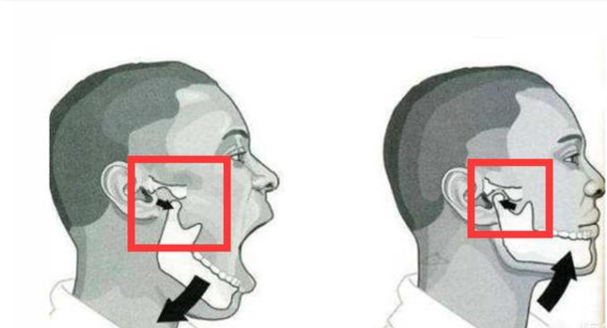 王源下颌骨脱位引网友心痛,专家为你解析"掉下巴"的原因