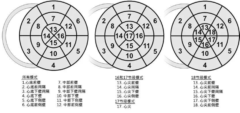 华医心诚超声心动图十大基本功:左心室节段分类