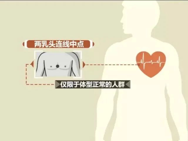 胸外心脏按压 位置:心脏按压部位——胸骨下半部,胸部正中央,两乳头