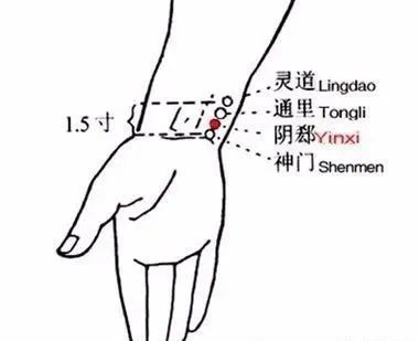 9,盗汗,起夜频繁——阴郄穴筑宾在小腿内侧,当太溪穴与阴谷穴的连线