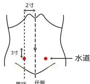 水道穴位于人体的下腹部,当脐中下3寸,距前正中线2寸.