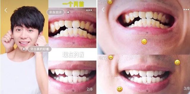 惊人发现牙齿"再生术",复旦大学潜心研发