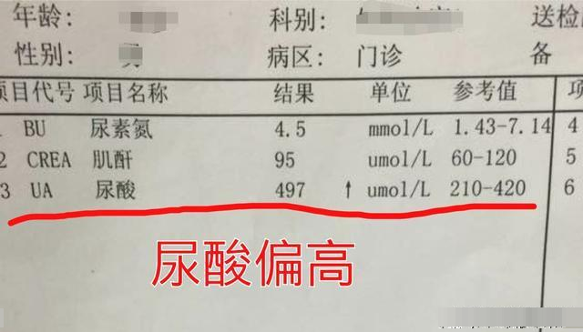 正常人尿酸是多少?尿素高又是怎么回事呢?_腾讯新闻