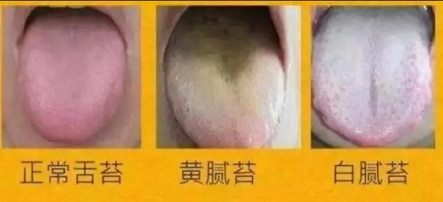 癌后口苦舌苔黄腻是身体这个部位出了问题