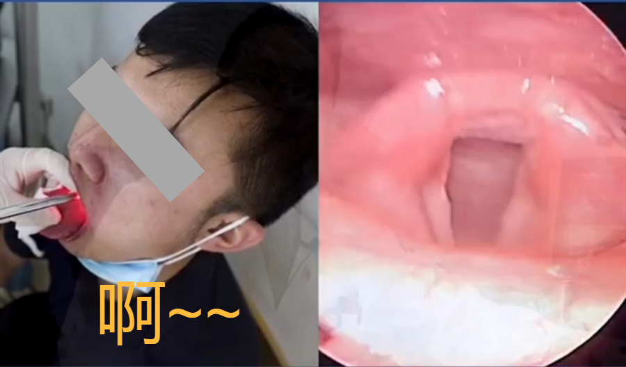 而发出 "噫"声时, 高频振动使声带拉紧,闭合,暴露在视野内,可以清楚的