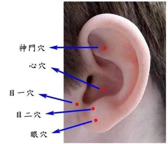 刺激耳部就会对相对应的五脏六腑产生治疗和调理作用艾灸耳朵通全身