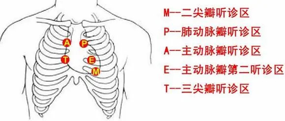 平静状态下听心脏的五个听诊区,了解是否有瓣膜杂音,心率不齐.