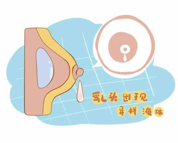 乳头溢液是正常的吗?