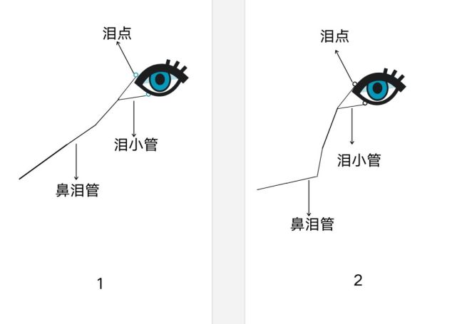 有的小体型犬泪小点缺失(如同洗手盆没有排水口,泪液生成之后从眼内