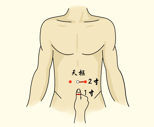 天枢穴灸法:艾条灸5-15分钟,每日或隔日灸1次