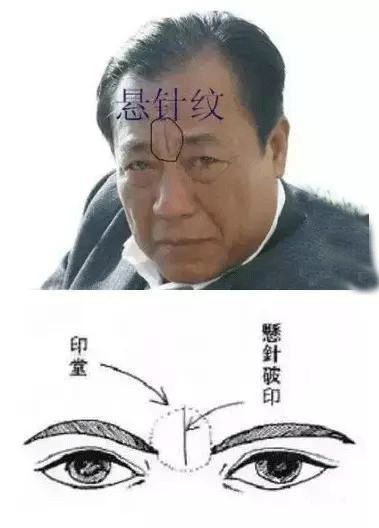 1,印堂上左右眉边上各一条纹的,左主兄弟右主姐妹,不和协,正义感重,爱