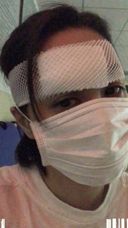阿娇头部受伤被缝数十针,12年了,你们还是不放过她!