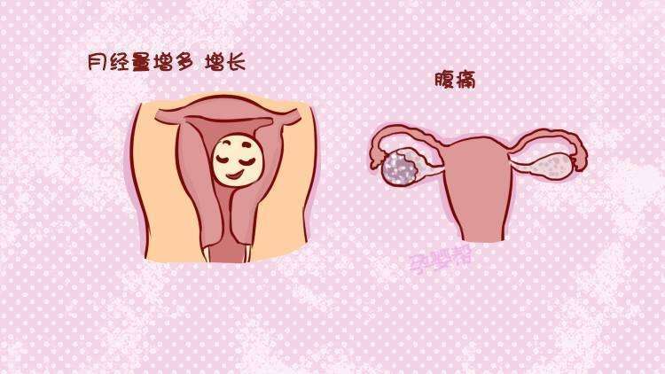 "我有卵巢囊肿,有鸡蛋那么大了,为什么会患上这个病?