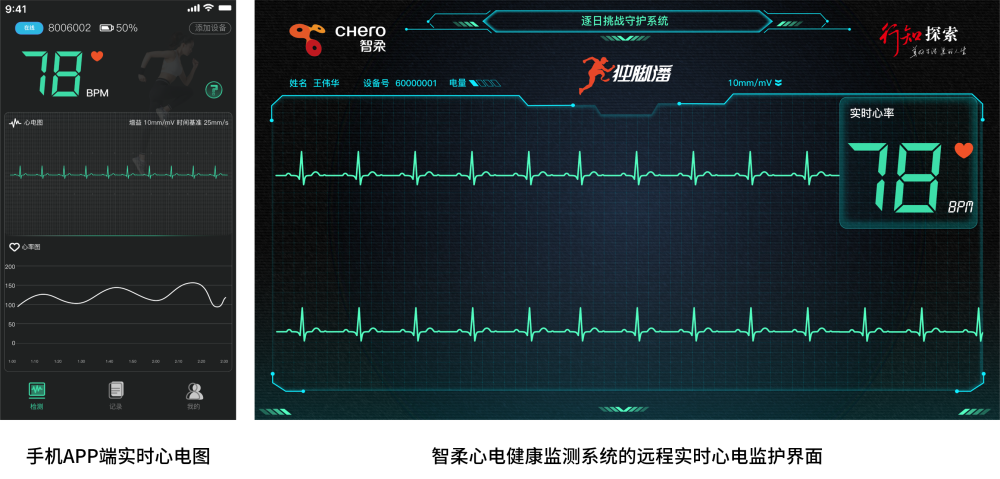 手机app实时心电监测及远程实时监护界面当前,刀锋战士已经奔跑在路上
