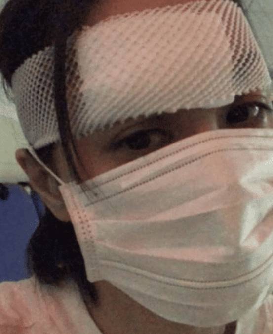 阿娇头部受伤缝数十针,容祖儿全程陪伴,赖弘国发文晒图有深意