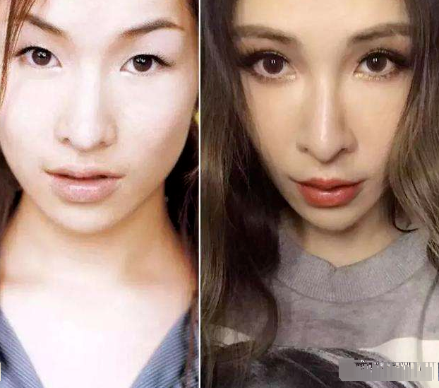 偷割双眼皮的女星,张雨绮周冬雨很成功,唯独她颜值下跌了!