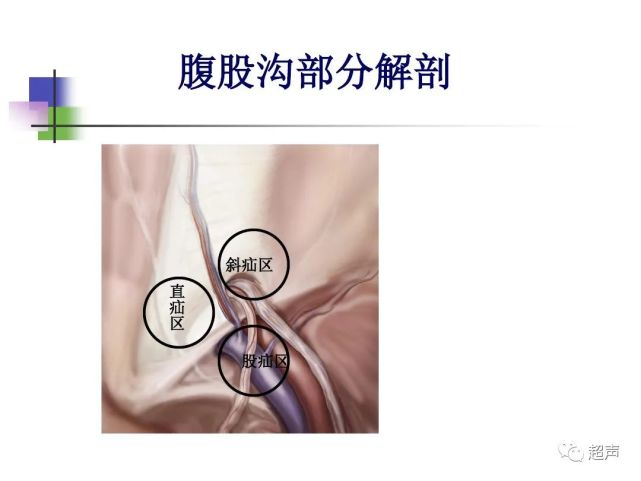 一图读懂腹股沟区解剖