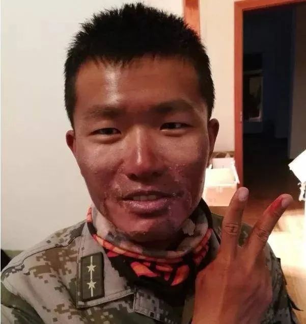 兵,因为在海拔近6000米的亚热拉山口巡逻,强烈的紫外线将他的脸晒得红