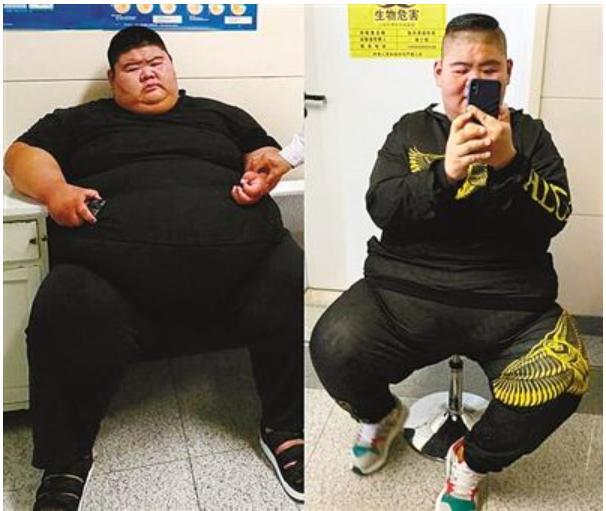真爱!中国第一胖子,体重668斤,为爱减肥1年内瘦400斤